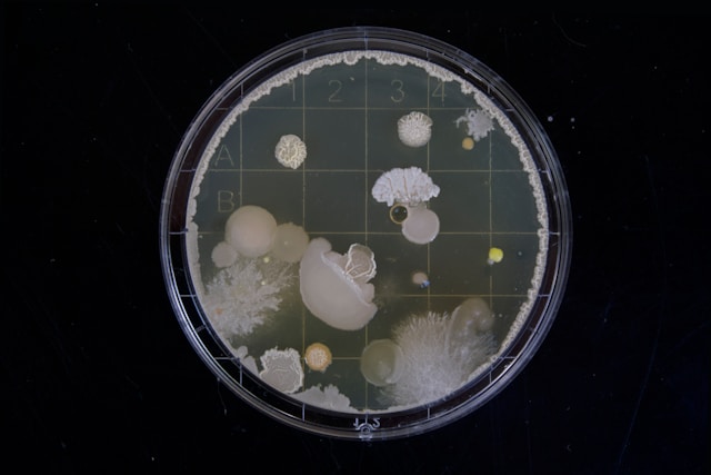 Mold Removal The Home Maintenance Task Too Many Property Owners Delay